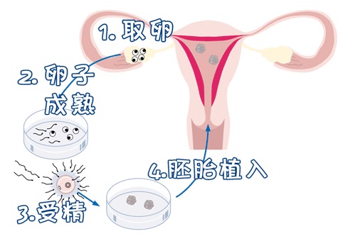 沪上生殖医学中心